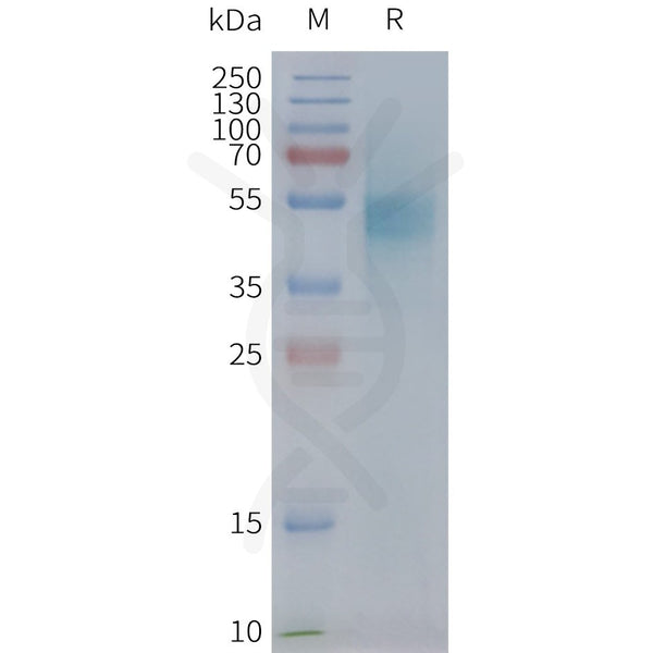 Human CXCR1 full length protein-synthetic nanodisc – Figure 1 of 1