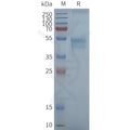 Human CCR1 full length protein-synthetic nanodisc – Figure 1 of 1