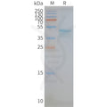 Human CCR5 full length protein-synthetic nanodisc – Figure 1 of 1