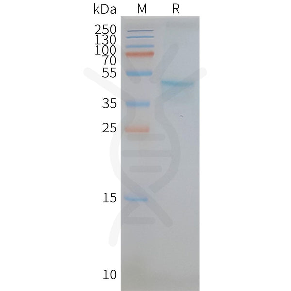 Human CCR5 full length protein-synthetic nanodisc – Figure 1 of 1