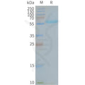 Human MFSD13A full length protein-synthetic nanodisc – Figure 1 of 1