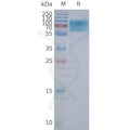 Human CHRM2 full length protein-synthetic nanodisc – Figure 1 of 1