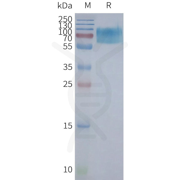 Human CHRM2 full length protein-synthetic nanodisc – Figure 1 of 1