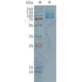 Human GLP2R full length protein-synthetic nanodisc – Figure 1 of 1