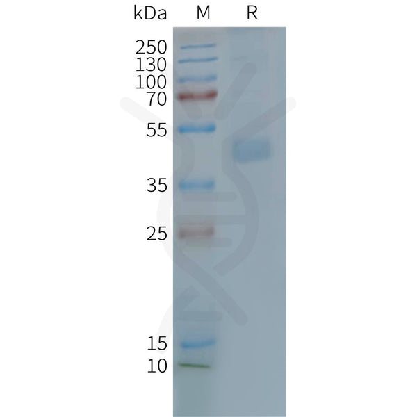Human CX3CR1 full length protein-synthetic nanodisc – Figure 1 of 1