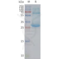 Human ADGRE5 full length protein-synthetic nanodisc – Figure 1 of 1