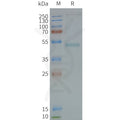 Human GRPR full length protein-synthetic nanodisc – Figure 1 of 1