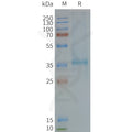 Human XCR1 full length protein-synthetic nanodisc – Figure 1 of 1