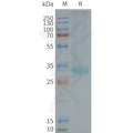 Human MC4R full length protein-synthetic nanodisc – Figure 1 of 1