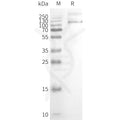 Human TRPV1 full length protein-synthetic nanodisc – Figure 1 of 1