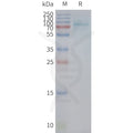 Human UTS2R full length protein-synthetic nanodisc – Figure 1 of 1