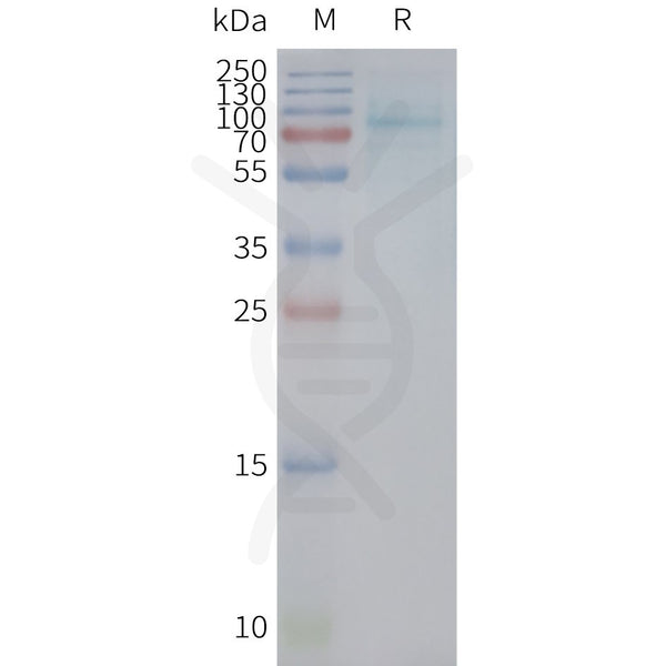 Human UTS2R full length protein-synthetic nanodisc – Figure 1 of 1