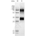 Human OR52D1 full length protein-synthetic nanodisc – Figure 1 of 1