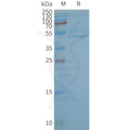 Human CB2 full length protein-synthetic nanodisc – Figure 1 of 1