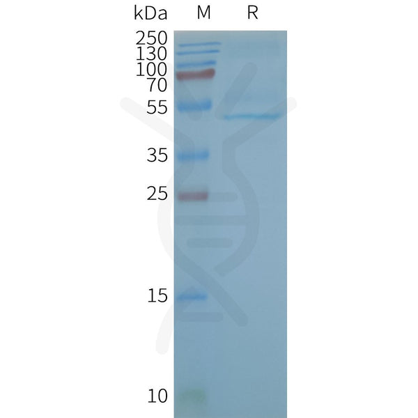 Human CB2 full length protein-synthetic nanodisc – Figure 1 of 1