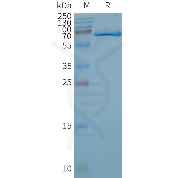 Human FZD4 full length protein-synthetic nanodisc – Figure 1 of 1