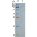 Human TLR2 full length protein-synthetic nanodisc – Figure 1 of 1