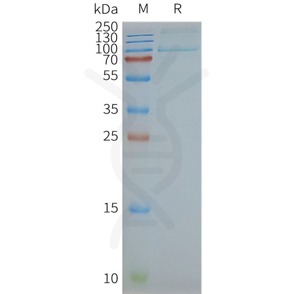 Human TLR2 full length protein-synthetic nanodisc – Figure 1 of 1