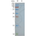 Human TLR4 full length protein-synthetic nanodisc – Figure 1 of 1