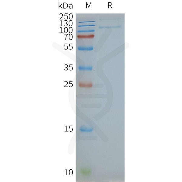 Human TLR4 full length protein-synthetic nanodisc – Figure 1 of 1