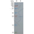 Human CAV1 full length protein-synthetic nanodisc – Figure 1 of 1
