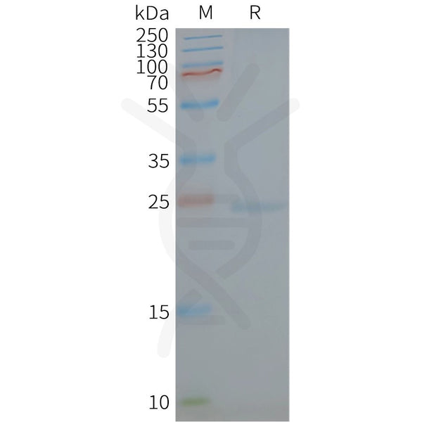 Human CAV1 full length protein-synthetic nanodisc – Figure 1 of 1