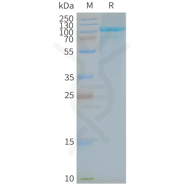 Human TLR5 full length protein-synthetic nanodisc – Figure 1 of 1