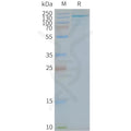 Human TLR7 full length protein-synthetic nanodisc – Figure 1 of 1
