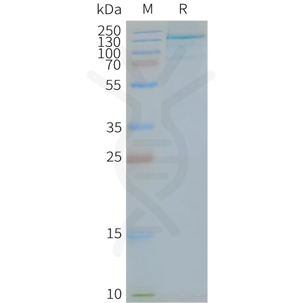 Human TLR7 full length protein-synthetic nanodisc – Figure 1 of 1