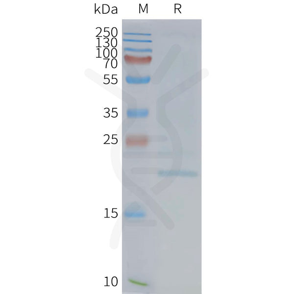 Human EMP2 full length protein-synthetic nanodisc – Figure 1 of 1