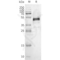 Human OR1E1 full length protein-synthetic nanodisc – Figure 1 of 1