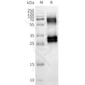 Human OR8U8 full length protein-synthetic nanodisc – Figure 1 of 1