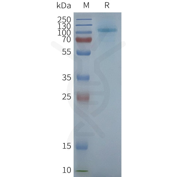 Human TAS1R3 full length protein-synthetic nanodisc – Figure 1 of 1