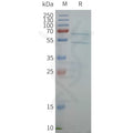 Human ABCG1 full length protein-synthetic nanodisc – Figure 1 of 1