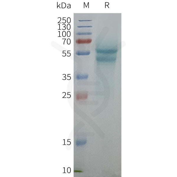 Human ADRB1 full length protein-synthetic nanodisc – Figure 1 of 1