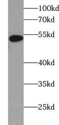 Western blot of 6*His-tagged fusion protein with FNab00009(anti-6*HIS tag) at dilution of 1:1000.