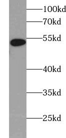 Western blot of 6*His-tagged fusion protein with FNab00009(anti-6*HIS tag) at dilution of 1:1000.