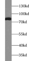 mouse heart tissue were subjected to SDS PAGE followed by western blot with FNab00016(AACS Antibody) at dilution of 1:300