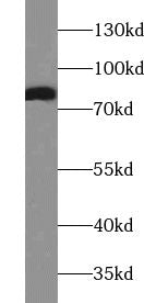 mouse heart tissue were subjected to SDS PAGE followed by western blot with FNab00016(AACS Antibody) at dilution of 1:300