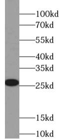 fetal human brain tissue were subjected to SDS PAGE followed by western blot with FNab09217(UCHL1 Antibody) at dilution of 1:20000