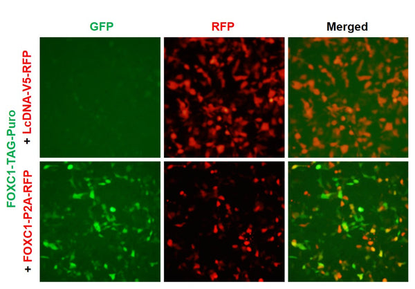 FOXC1 Reporter Lentivirus – Figure 1