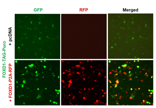 FOXD1 Reporter Lentivirus – Figure 1
