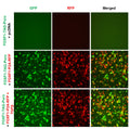 FOXF1 Reporter Lentivirus – Figure 1 of 7