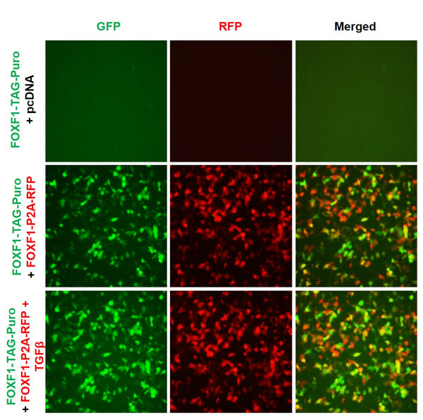 FOXF1 Reporter Lentivirus – Figure 1 of 7