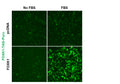 FOXK1 Reporter Lentivirus – Figure 1