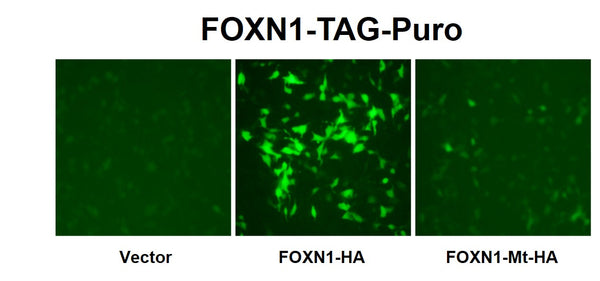 FOXN1 Reporter Lentivirus – Figure 1 of 4