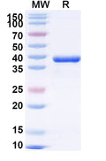 Recombinant Cat Fel d 1A/CH1 Protein, N-GST & C-His