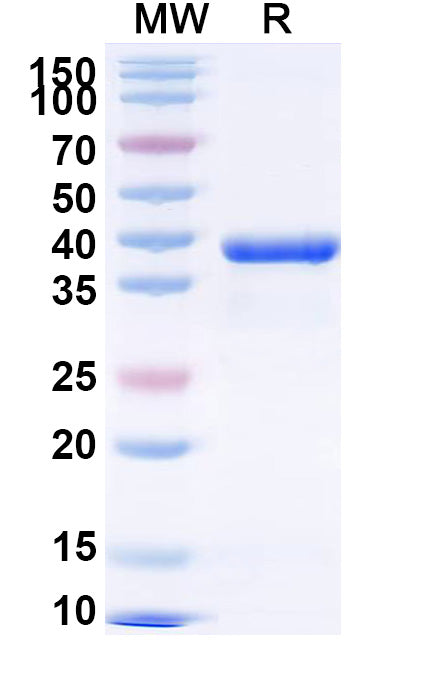 Recombinant Cat Fel d 1A/CH1 Protein, N-GST & C-His