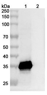 Anti-Fel d 1 Allergen Reference Antibody (Mevonlerbart) – Figure 1 of 1