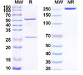 SDS-PAGE for Anti-CH1&CH2/Allergen Fel d I-A&B Antibody (SAA0617)